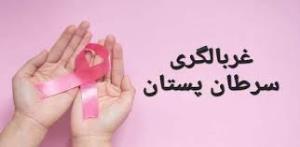 غربالگری کنسر breast 