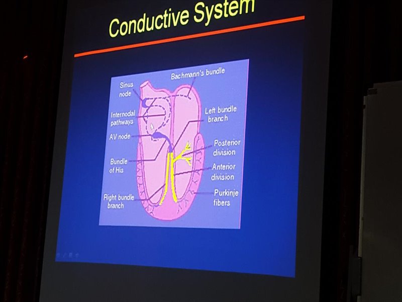 ECG