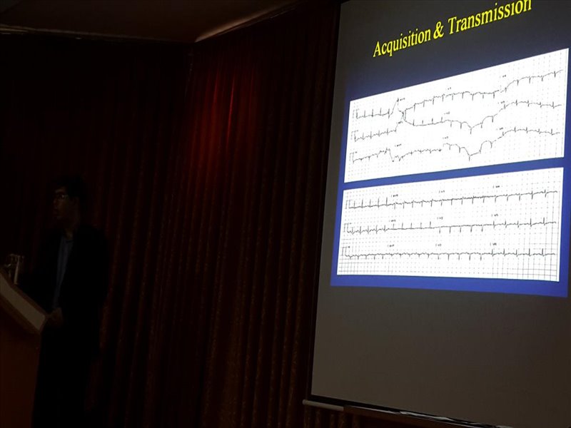 ECG